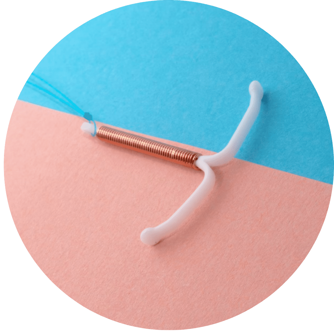 Intrauterine Device (IUD) fitting
