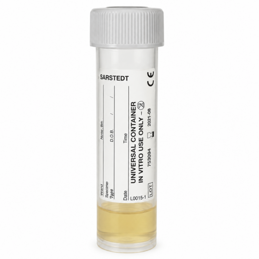 Urine sample container with a small amount of urine inside